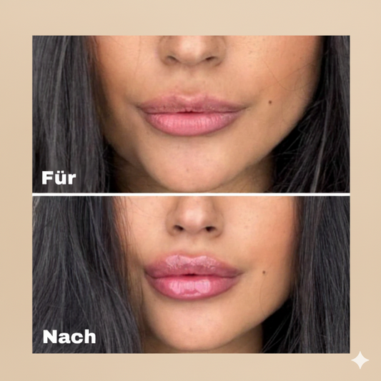 Extremer Lippenfüller - Von Mooibelle